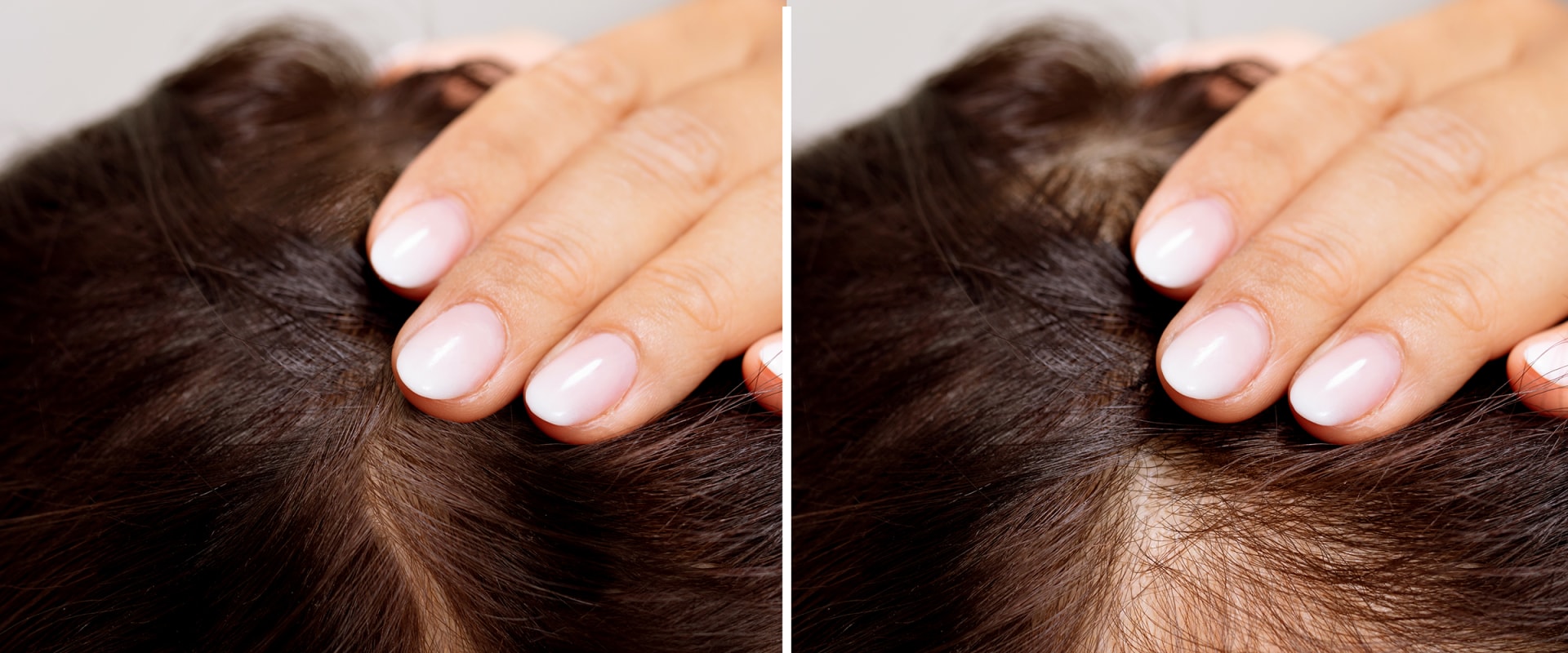 Hair Care Routine for Managing Female Hair Loss: Tips and Advice for Seniors