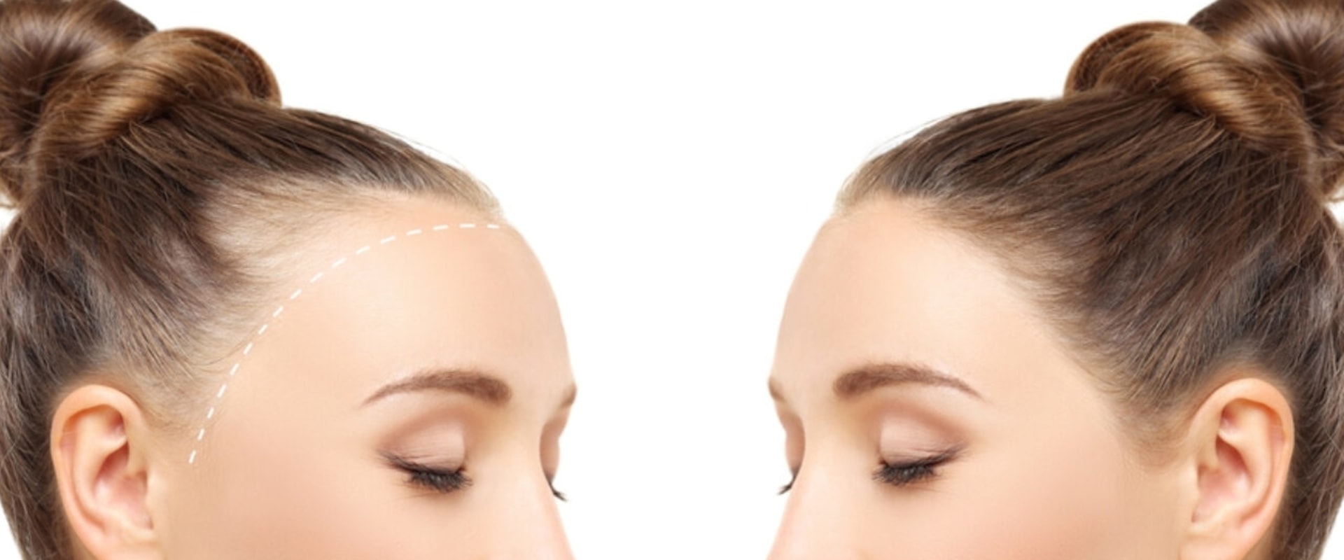 Understanding Pregnancy and Postpartum Hair Loss