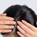 Scalp Treatments for Hair Growth: Everything You Need to Know