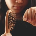 Natural Remedies for Female Hair Loss: Tips and Advice for Maintaining Senior Health