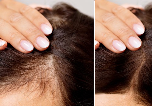 Hair Care Routine for Managing Female Hair Loss: Tips and Advice for Seniors