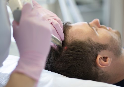 Exploring Low-Level Laser Therapy (LLLT) for Senior Hair Loss