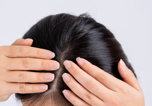 Scalp Treatments for Hair Growth: Everything You Need to Know