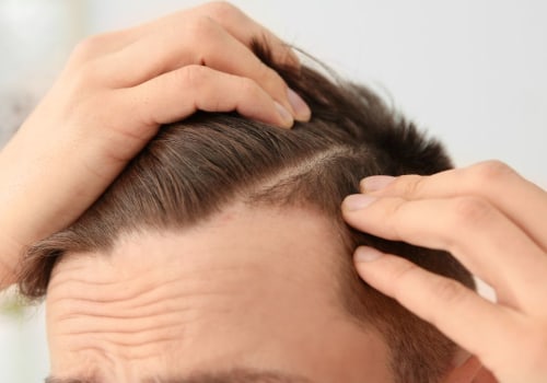 Understanding Finasteride: A Complete Guide for Senior Care
